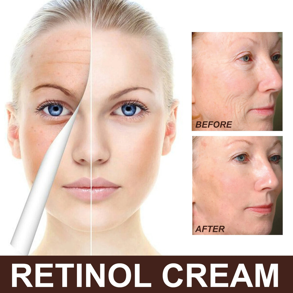EELHOE Retinol Hyaluronic Acid Cream 50ml Anti-Aging Firming Brightening Moisturizing Facial Skin Care Cream GMP Certificate